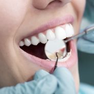 Dental restorations for missing teeth |  Bridges, dental implants and dentures in Richmond